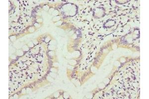 Immunohistochemistry of paraffin-embedded human small intestine tissue using ABIN7157611 at dilution of 1:100
