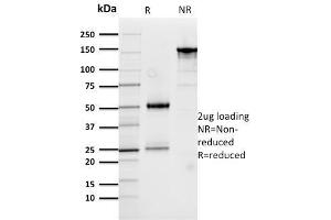 SDS-PAGE (SDS) image for anti-Cathepsin D (CTSD) (AA 104-250) antibody (ABIN6939218)