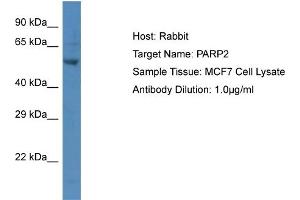 Host:  Rabbit  Target Name:  P Sample Type:  MCF7 Whole Cell lysates  Antibody Dilution:  1. (PARP2 antibody  (C-Term))