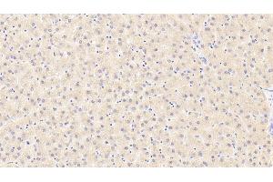 Detection of LIPC in Human Liver Tissue using Polyclonal Antibody to Lipase, Hepatic (LIPC) (LIPC antibody  (AA 347-478))