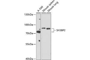 Western blot analysis of extracts of various cell lines, using SH3BP2 antibody (ABIN6130687, ABIN6147721, ABIN6147722 and ABIN6214417) at 1:1000 dilution. (SH3BP2 antibody  (AA 392-561))