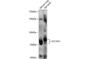 Western blot analysis of extracts of various cell lines, using SLC15 antibody (0246) at 1:1000 dilution. (SLC15A1 antibody  (AA 600-700))