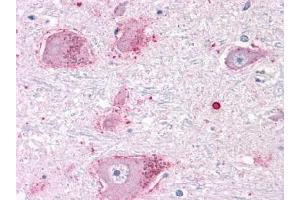 Immunohistochemical staining of Brain (Neurons and Glia) using anti- CHRM3 antibody ABIN122325