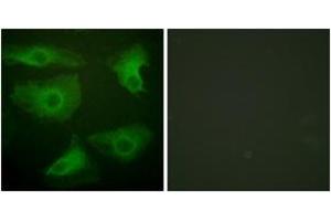 Immunofluorescence analysis of HeLa cells, using IkappaB-epsilon (Phospho-Ser22) Antibody. (IkappaB-epsilon antibody  (pSer22))