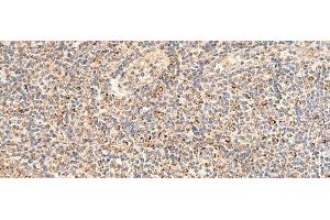 Immunohistochemistry of paraffin-embedded Human tonsil tissue using MRPL16 Polyclonal Antibody at dilution of 1:50(x200) (MRPL16 antibody)