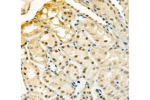 Immunohistochemistry of paraffin embedded mouse kidney using Adenosine kinase (ABIN7072953) at dilution of 1: 300 (400x lens)