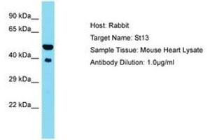 Image no. 1 for anti-Suppression of Tumorigenicity 13 (ST13) (AA 41-90) antibody (ABIN6750401) (HSC70 Interacting Protein HIP antibody  (AA 41-90))