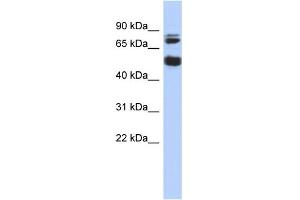 WB Suggested Anti-MGC42105 Antibody Titration: 0. (NIM1 antibody  (Middle Region))