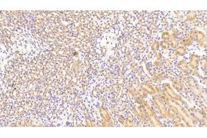 Detection of TGFbR3 in Mouse Kidney Tissue using Polyclonal Antibody to Transforming Growth Factor Beta Receptor III (TGFbR3) (TGFBR3 antibody  (AA 469-724))