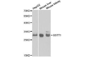 Western blot analysis of extracts of various cell lines, using GSTT1 antibody. (GSTT1 antibody  (AA 1-240))