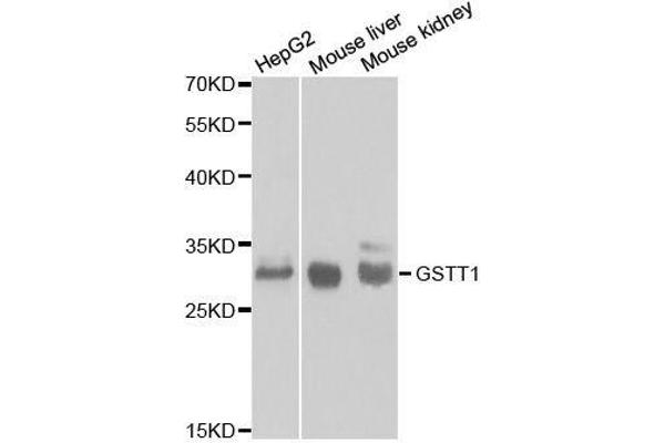 GSTT1 anticorps  (AA 1-240)