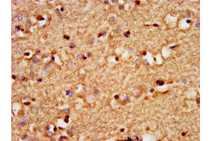 IHC image of ABIN7172623 diluted at 1:300 and staining in paraffin-embedded human brain tissue performed on a Leica BondTM system. (SOX3 antibody  (AA 4-118))