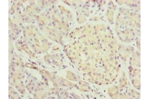 Immunohistochemistry (IHC) image for anti-Midline 2 (MID2) (AA 506-735) antibody (ABIN7164439)