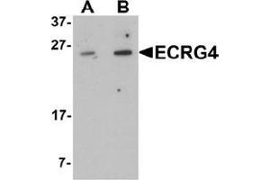 Western blot analysis of ECRG4 in HeLa cell lysate with ECRG4 Antibody  at (A) 1 and (B) 2 μg/mL (C2orf40 antibody  (C-Term))