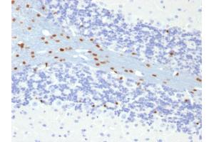 Immunohistochemistry (IHC) image for anti-SRY (Sex Determining Region Y)-Box 10 (SOX10) (AA 115-269) antibody (ABIN6940623)