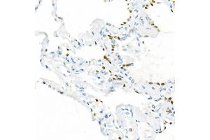 Immunohistochemistry of paraffin-embedded Human lung using TTF1 antibody (ABIN1679475, ABIN3017648, ABIN3017649 and ABIN7101514) at dilution of 1:1000 (40x lens). (NKX2-1 antibody)