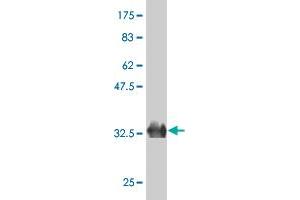 Western Blot detection against Immunogen (36. (ZFP14 antibody  (AA 70-161))