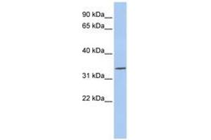 Image no. 1 for anti-Paired-Like Homeodomain 1 (PITX1) (AA 36-85) antibody (ABIN6740295) (PITX1 antibody  (AA 36-85))