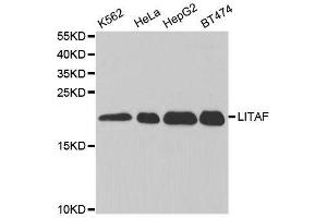 Western blot analysis of extracts of various cell lines, using LITAF antibody. (LITAF antibody  (AA 1-161))