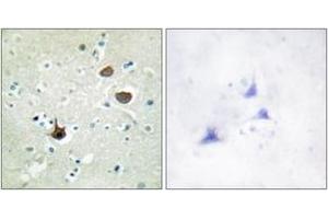 Immunohistochemistry analysis of paraffin-embedded human brain, using CXCR4 (Phospho-Ser339) Antibody. (CXCR4 antibody  (pSer339))