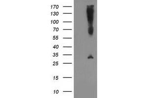 HEK293T cells were transfected with the pCMV6-ENTRY control (Left lane) or pCMV6-ENTRY SNAP25 (Right lane) cDNA for 48 hrs and lysed. (SNAP25 antibody)