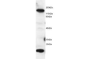 Image no. 1 for anti-5-Methyltetrahydrofolate-Homocysteine Methyltransferase (MTR) (C-Term) antibody (ABIN374080) (MTR antibody  (C-Term))
