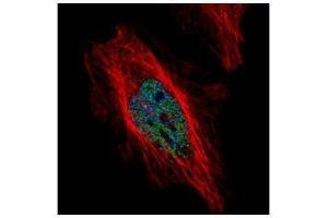 ICC/IF Image Confocal immunofluorescence analysis (Olympus FV10i) of paraformaldehyde-fixed HeLa, using DYRK1B, antibody (Green) at 1:500 dilution. (DYRK1B antibody  (N-Term))