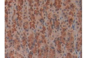 DAB staining on IHC-P; Samples: Rat Stomach Tissue (LDLR antibody  (AA 335-588))