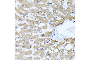 Immunohistochemistry of paraffin-embedded human liver injury using NDUFS3 antibody. (NDUFS3 antibody  (AA 37-264))