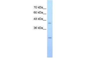 WB Suggested Anti-FLJ20489 Antibody Titration:  0. (FLJ20489 (C-Term) antibody)