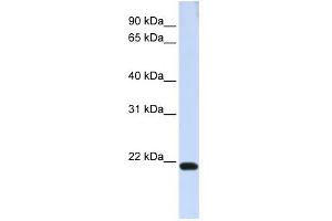 TJAP1 antibody used at 1 ug/ml to detect target protein. (TJAP1 antibody)