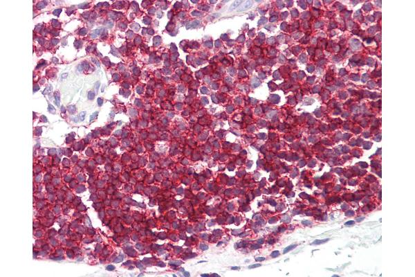 Septin 9 antibody  (C-Term)