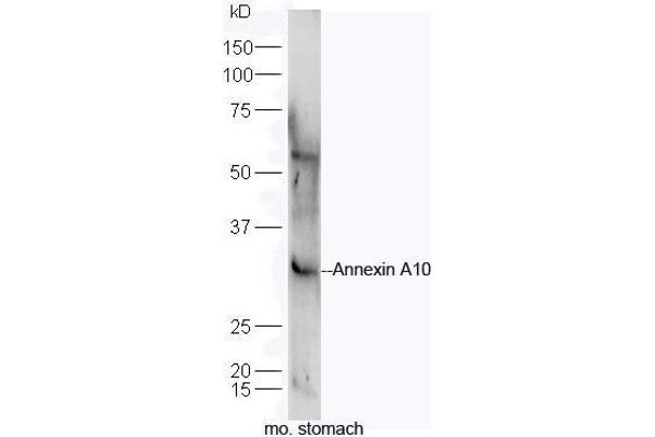 Annexin a10 antibody  (AA 251-324)
