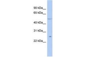 Image no. 1 for anti-Tetratricopeptide Repeat Domain 8 (TTC8) (AA 71-120) antibody (ABIN6743520) (TTC8 antibody  (AA 71-120))