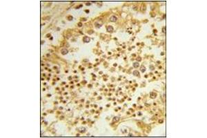 Immunohistochemistry analysis in Formalin Fixed, Paraffin Embedded Human Testis using RPL31 Antibody (Center) followed by peroxidase conjugation of the secondary antibody and DAB staining.