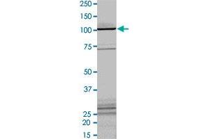 Image no. 1 for Protein Kinase C, iota (PRKCI) (AA 1-587) (Active) protein (His-GST) (ABIN5570589) (PKC iota Protein (AA 1-587) (His-GST))