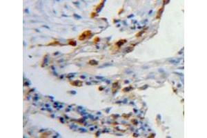 Used in DAB staining on fromalin fixed paraffin-embedded lung tissue (Latexin antibody  (AA 1-222))