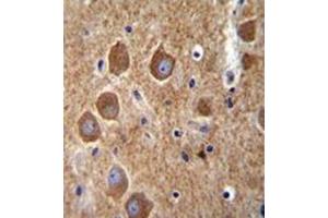 Immunohistochemistry analysis in formalin fixed and paraffin embedded human brain tissue reacted with AP53154PU-N, which was peroxidase conjugated to the secondary antibody and followed by DAB staining. (PAK6 antibody  (Middle Region))