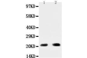 Anti-PUMA antibody, Western blotting All lanes: Anti PUMA at 0. (PUMA antibody  (C-Term))