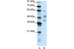 WB Suggested Anti-APTX Antibody Titration:  1. (Aprataxin antibody  (N-Term))