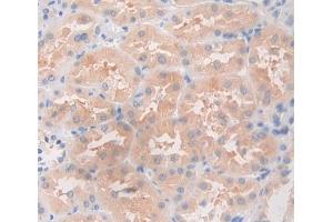 Used in DAB staining on fromalin fixed paraffin- embedded Kidney tissue (ANGPTL5 antibody  (AA 141-383))