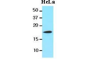 The lysates of HeLa(20 ug) were resolved by SDS-PAGE, transferred to nitrocellulose membrane and probed with anti-human Cofilin 1(1:1000) antibody.