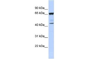 Western Blotting (WB) image for anti-Sex Comb On Midleg-Like 4 (SCML4) antibody (ABIN2458097) (SCML4 antibody)