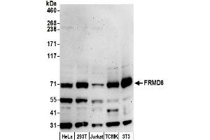 Western Blotting (WB) image for anti-FERM Domain Containing 6 (FRMD6) (AA 572-622) antibody (ABIN7452610)
