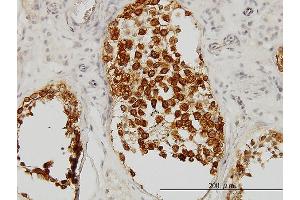 Immunoperoxidase of monoclonal antibody to DAZ1 on formalin-fixed paraffin-embedded human testis. (DAZ1 antibody  (AA 21-120))