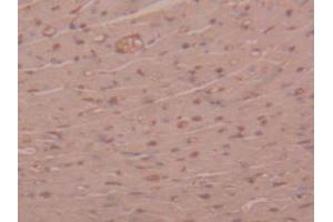 Figure. (alpha 2 Macroglobulin antibody  (AA 1053-1214))
