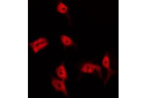 ABIN6274518 staining 293 by IF/ICC. (BRMS1 antibody  (N-Term))