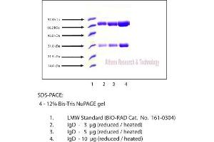 Gel Scan of Immunoglobulin D (IgD), Human Plasma  This information is representative of the product ART prepares, but is not lot specific. (IgD Protein)