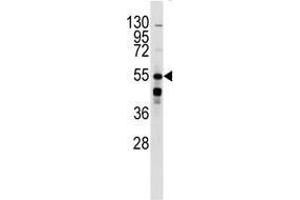Western blot analysis of anti-BAR2 Antibody in mouse kidney lysates (35 µg/lane). (beta 2 Adrenergic Receptor antibody  (Ser261))
