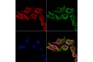 ABIN6256941 and ABIN6274588 staining Hela cells by IF/ICC. (beta Arrestin 1 antibody  (C-Term))
